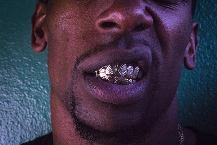 4 caractéristiques des grillz de dents